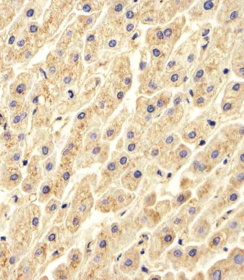 CTSD / Cathepsin D Antibody