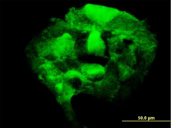 PAPSS2 Antibody (clone 2A8)