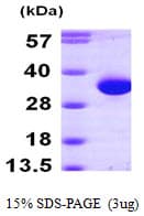 Human HDHD2 Protein (Recombinant His)