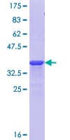 Human KMT2B / MLL4 Protein (Recombinant GST, N-terminus)
