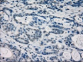 FRK Antibody (clone OTI5G4)