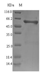 Salmonella typhi ompS1 Protein (Recombinant 6His-SUMO, N-terminus)