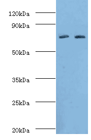 ALOX15B / 15-LOX-2 Antibody (aa1-200)