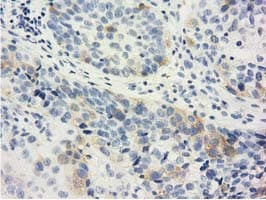 LIN7B Antibody (clone OTI1C9)
