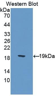 HSPBP1 Antibody (aa198-352, PE)