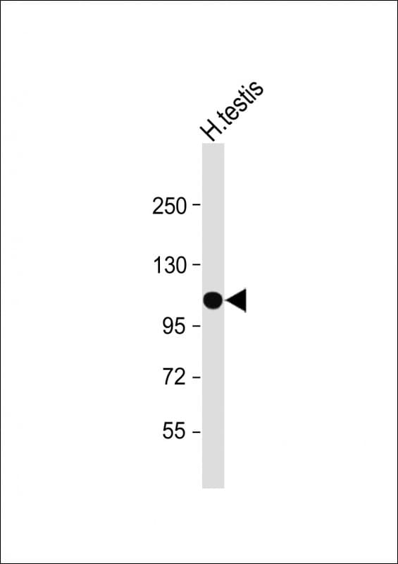 SLC14A2 / UTR Antibody (N-Terminus)