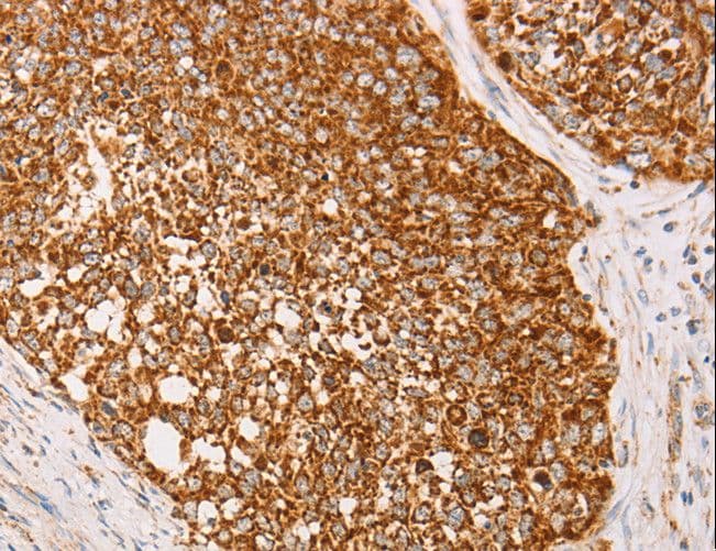 AK2 / Adenylate Kinase 2 Antibody