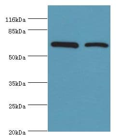 CTPS Antibody (aa79-388)