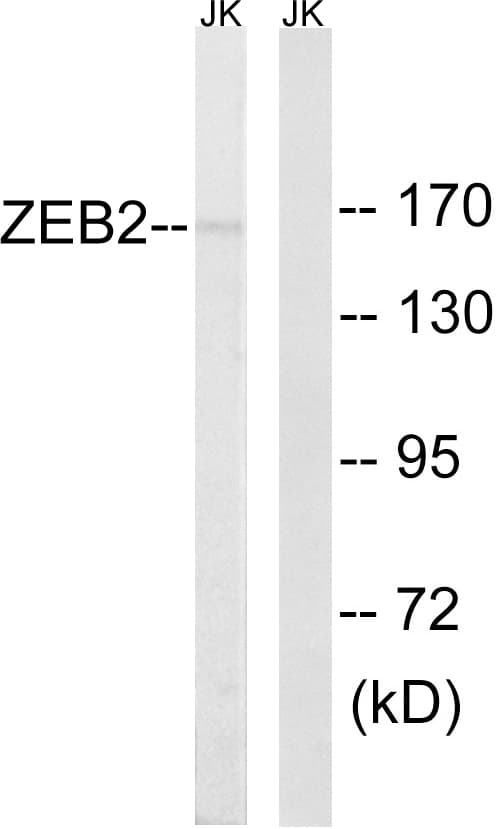 IHC-plus™ Polyclonal Rabbit anti-Human ZEB2 / SIP-1 Antibody (aa71-120, IHC, WB)