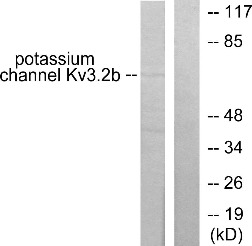 PathPlus™ Polyclonal Rabbit anti-Human KCNC2 / Kv3.2 Antibody (aa589-638, IHC, WB)
