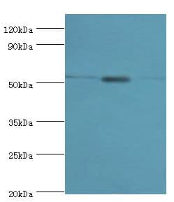 CAMK1G / CaMKI gamma Antibody (aa217-476)