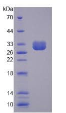 Human SPTBN4 Protein (Recombinant His-T7)