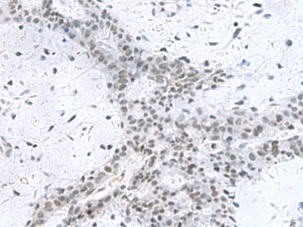 Polyclonal Rabbit anti-Human PCNA-Associated Factor Antibody (IHC)