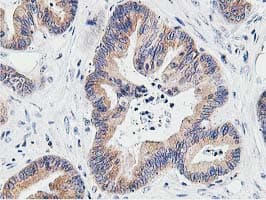 LCMT1 Antibody (clone OTI4A5, Carrier-free)