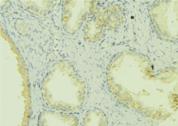 SHARPIN Antibody