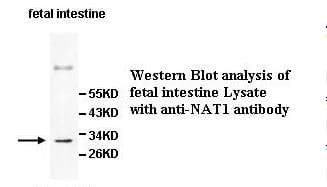 NAT1 / AAC1 Antibody