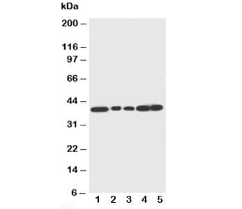 DCN / Decorin Antibody (aa343-359)