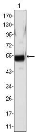 IHC-plus™ Monoclonal Mouse anti-Human FGB / Fibrinogen Beta Chain Antibody (clone 1F9, IHC, WB)