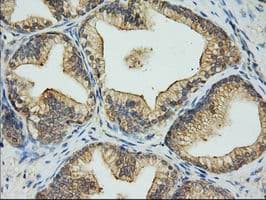 Monoclonal Mouse anti-Human EIF2S1 Antibody (clone OTI1H1, IHC, WB)