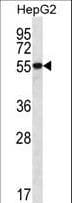 Polyclonal Rabbit anti-Human UGDH / UDPGDH Antibody (aa465-494, IHC, WB)