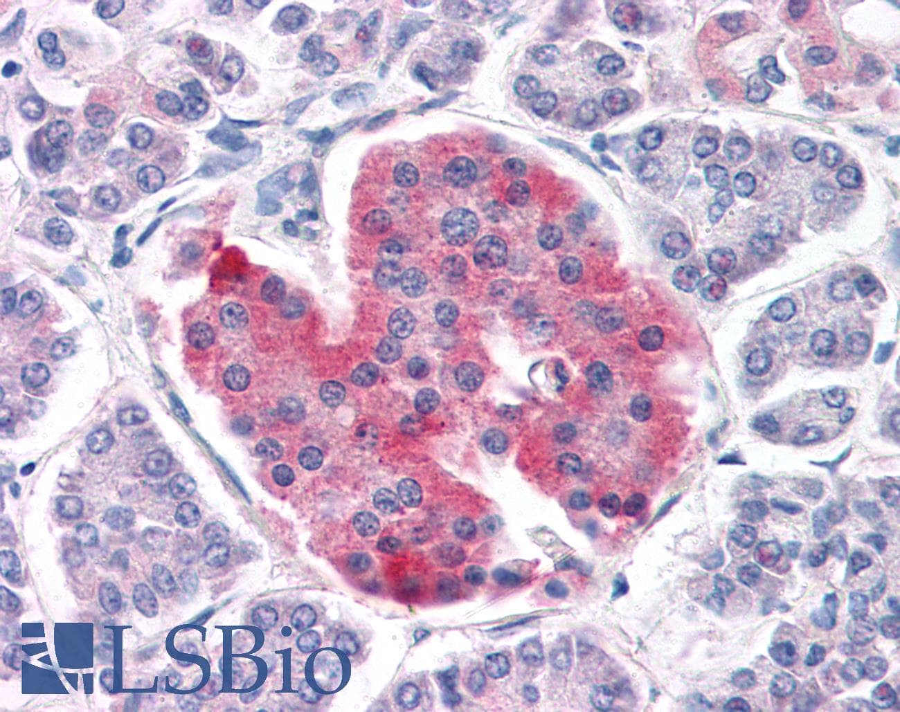 IHC-plus™ KCNJ11 / Kir6.2 Antibody (aa18-30)