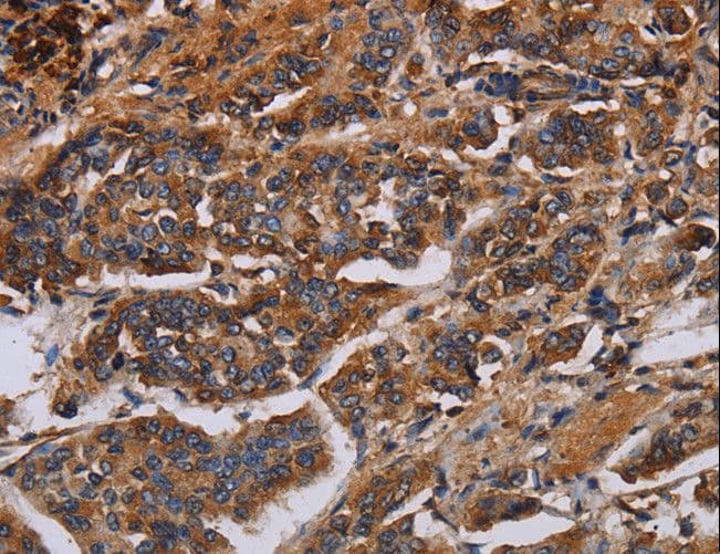 KCNQ1 / KVLQT1 Antibody