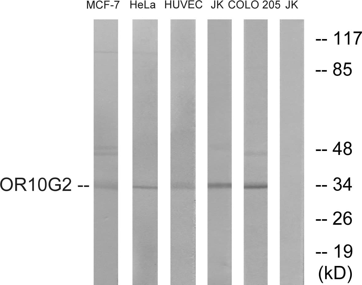 OR10G2 Antibody (aa241-290)