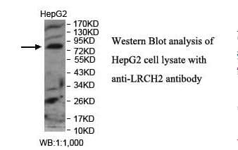 LRCH2 Antibody (aa554-742)