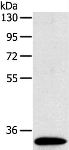 Polyclonal Rabbit anti-Human SULT1B1 / Sulfotransferase 1B1 Antibody (IHC, WB)