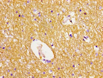DLG2 / PSD93 Antibody