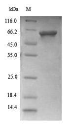 Candida albicans ACP 9, SAP9 Protein (Recombinant 6His, N-terminus)