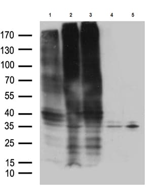 GPR17 Antibody (C-Terminus, clone OTI17C1)
