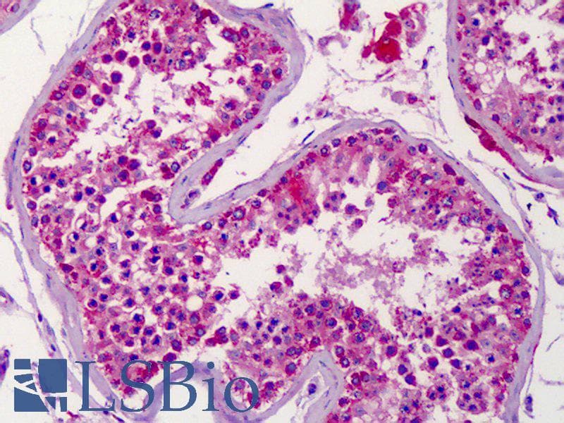 IHC-plus™ EPHA6 / EPH Receptor A6 Antibody (aa891-940)
