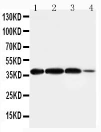 ARG2 / Arginase 2 Antibody (aa67-85)