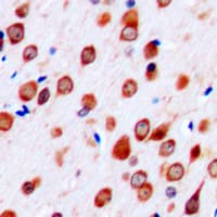 NTM / Neurotrimin Antibody (C-Terminus)