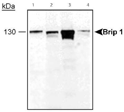 BRIP1 / BACH1 Antibody (C-Terminus)