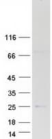 Human APOBEC3C Protein (Recombinant Myc-DDK (Flag))