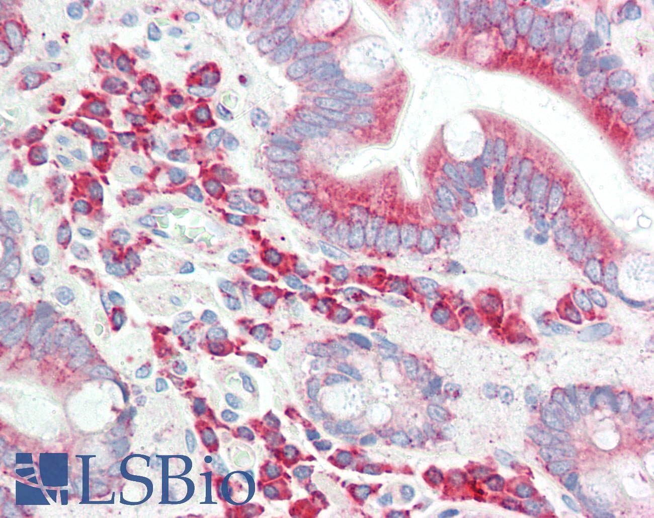 IHC-plus™ FASTKD1 Antibody (aa561-610)