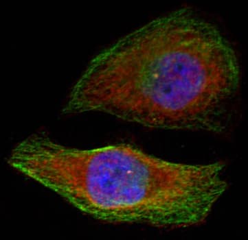 MAPK3 / ERK1 Antibody (phospho-Thr202)