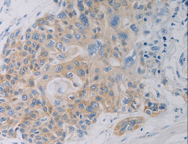 CLEC4C / CD303 / BDCA-2 Antibody