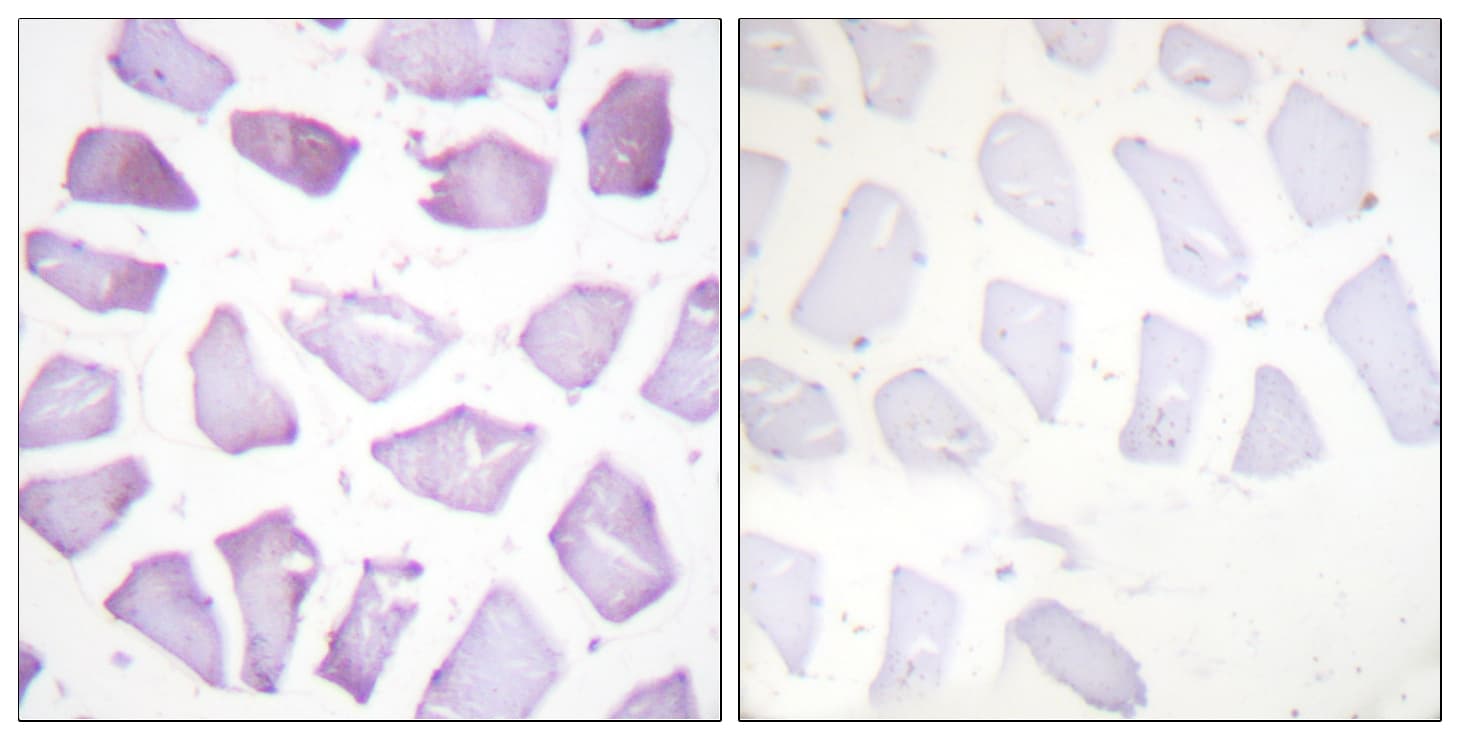 PEA15 / PEA-15 Antibody (phospho-Ser116)