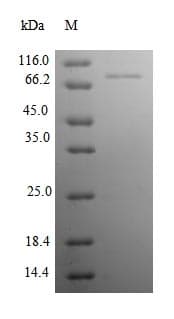 Human NDUFB10 Protein (Recombinant GST, N-terminus)