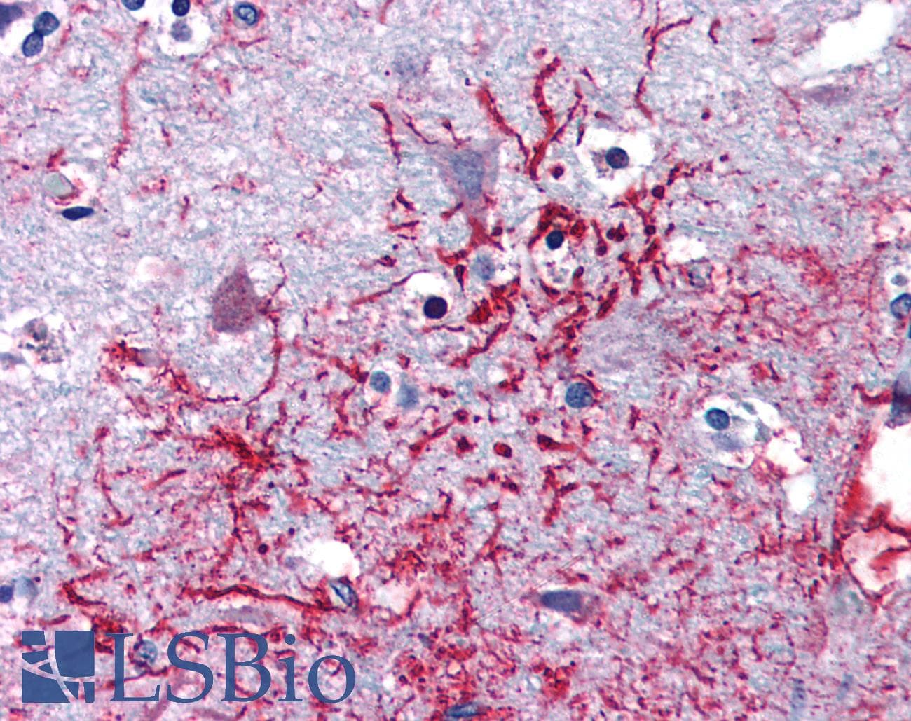 IHC-plus™ DHX58 / LGP2 Antibody