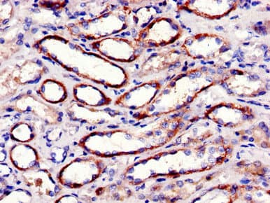 FAK / Focal Adhesion Kinase Antibody
