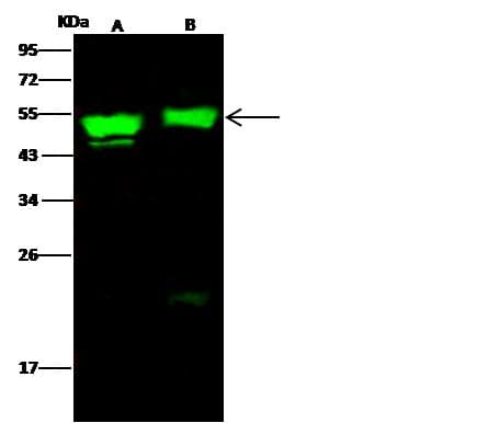Polyclonal Rabbit anti-Human KRT17 / CK17 / Cytokeratin 17 Antibody (Preservative Free, IF, WB)