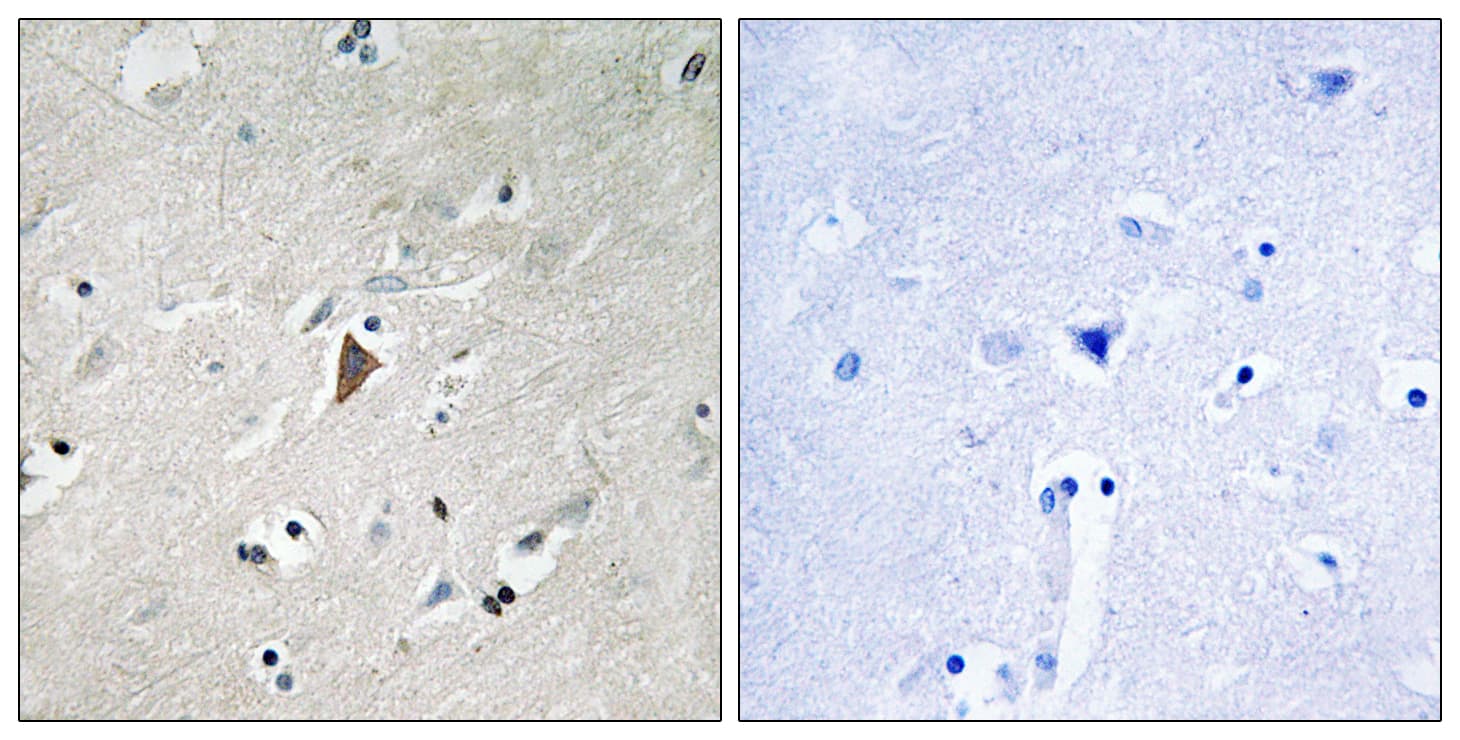 PDPK1 / PDK1 Antibody (phospho-Tyr9)