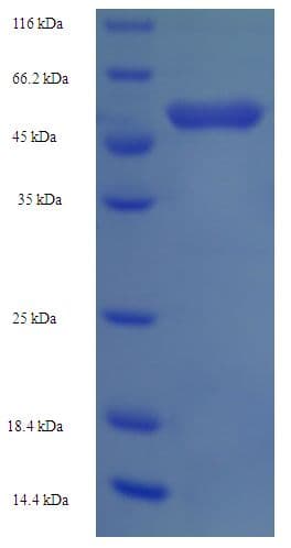 Human OXCT1 Protein (Recombinant His)