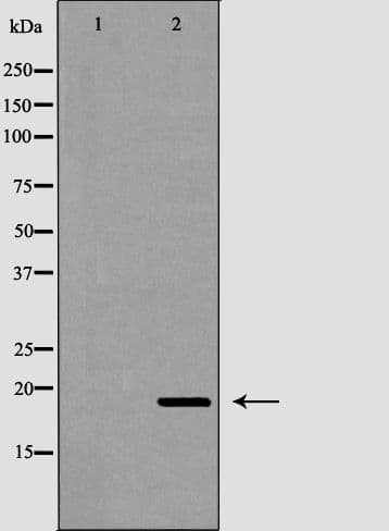FTL / Ferritin Light Chain Antibody