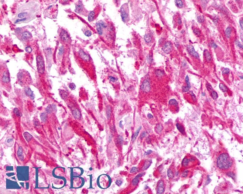 IHC-plus™ CXCR2 Antibody (N-Terminus)