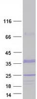 Human CHMP1A Protein (Recombinant Myc-DDK (Flag))